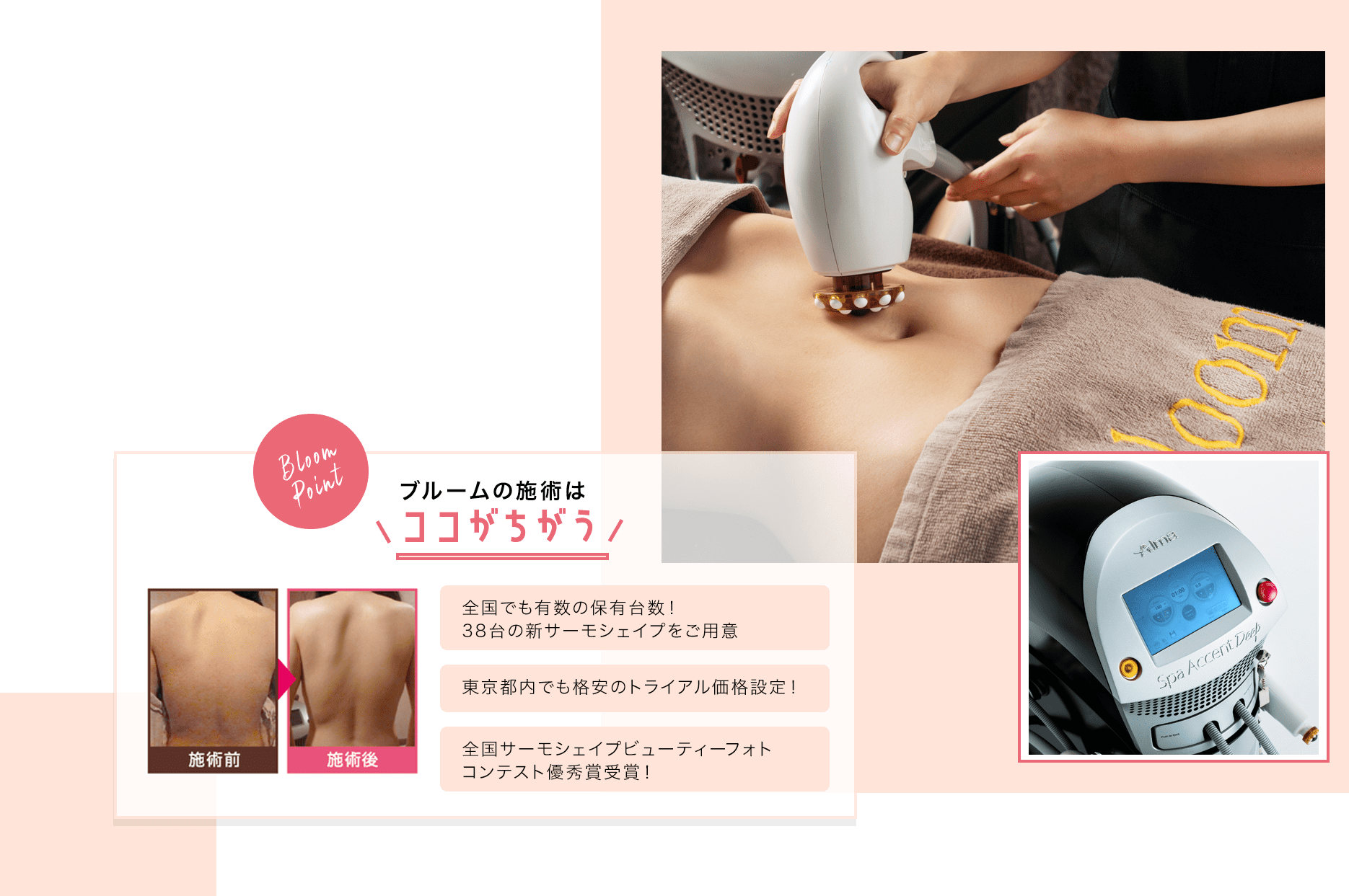 サーモシェイプ