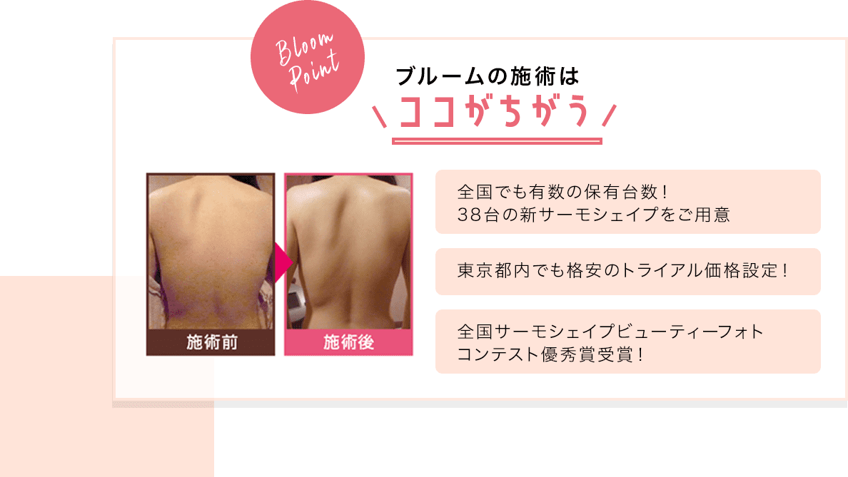 サーモシェイプ