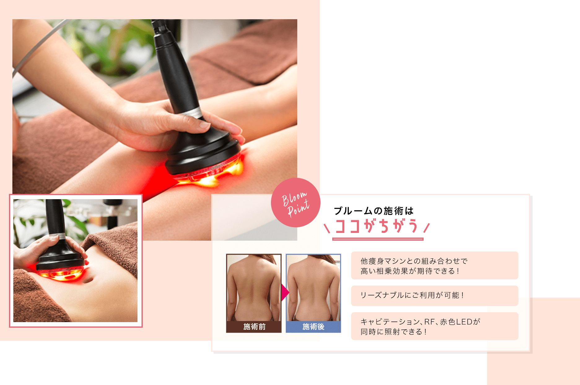 キャビテーション