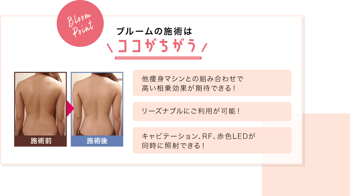 キャビテーション